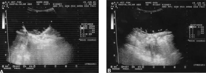 Şekil 1A-B. Ultrasnografide, sol ve sağ böbreğin görünümü. A. Sol böbrek B. Sağ böbrek 