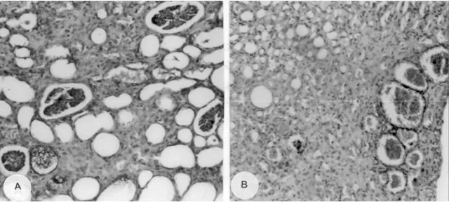 Şekil 5A-B. Renal paranşimin histopatolojik görünümü.  Figure 5A-B.  Histopathologic appearance of renal parenchyma