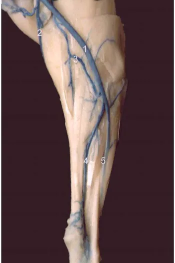Şekil 3. V. saphena lateralis ve dalları  Figuer 3. V. saphena lateralis and its branches 