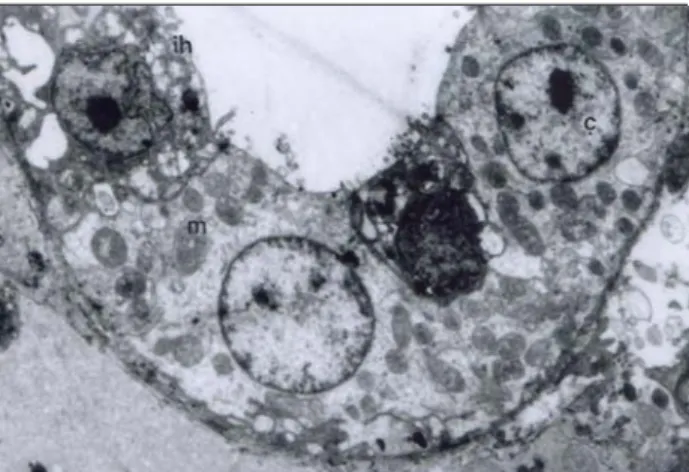 Figure 6. The electron microscopic appearance of the tubulus  proximalis. ç: nucleus, l: lysosome, m: mitochondrion, arrow:  microvillus