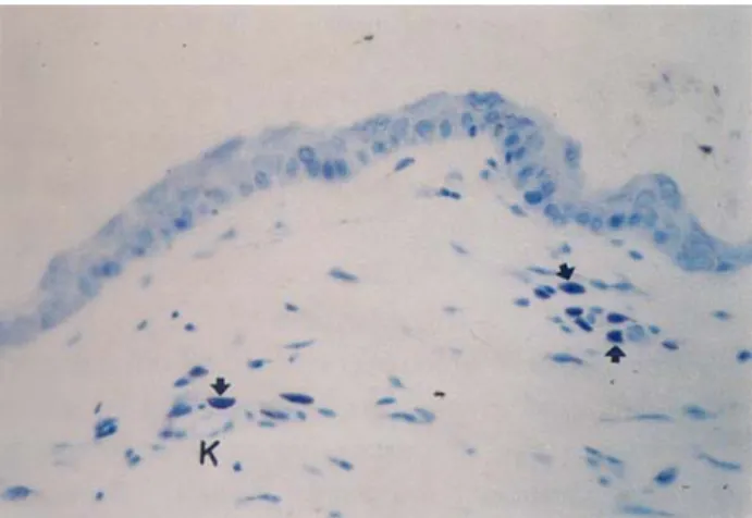 Figure 1. The appearance of the mast cells (arrows) in cheek  skin by fixed IFAA. K: Blood vessel
