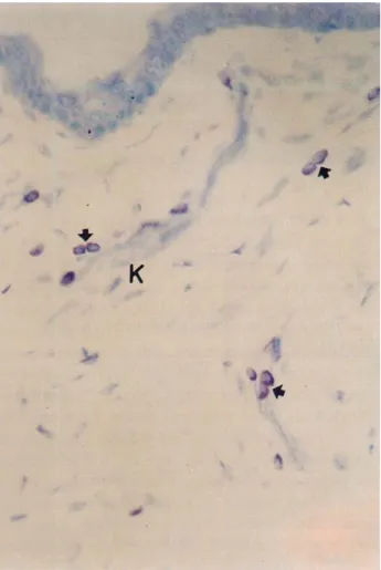 Figure 4. AB (+) mast cell (arrow) in thigh skin by fixed 10%  formaldehyde. AB/SO stain.x785