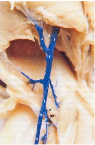 Şekil 3. Vena axillaris’ten çıkan damarlar.  Figure 3. Axillary vein’s branches. 