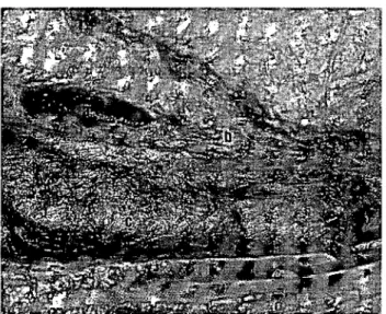 Figure 2. Right view of the efferent Jymph duct and superfical cervical Iymph node. x12.