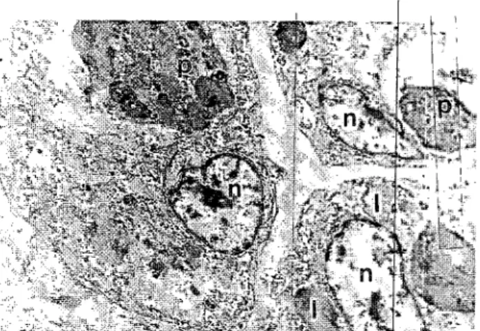 Figure l. Nodular growths (arrows) in unhealed operation site in postoperative 22 'h day.