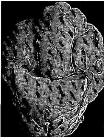 Şekil 3. Cerebellum'un önden görünümü. Figııre 3. Rastral view of the cerebellum.