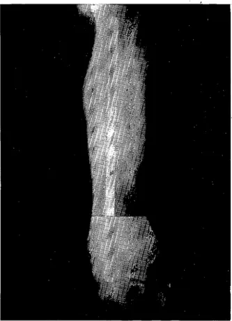 Şekil 3. Olgunun 6 ay sonraki latero-medial radyografisi. Figure 3. Postoperatiye latero-medial radiographie yiew of the ease in six months.