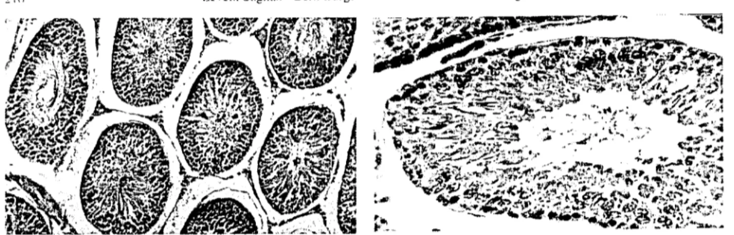 Figure 4. The untidy appcaranee in the semınıferolIS llIbulc~ dı. aıneters. the germinal epithelium that covcrs ~onıe tubule~ arc eompletely reınoved