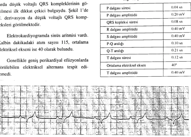Table I. Some eehoeardiographic values in Icad ii in the dog with pericardial effusion.