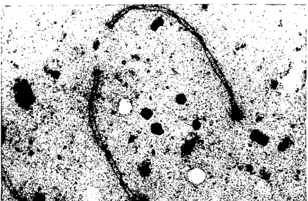 Figure 2. The only lateral elements showed granular positive reaction in the synaptonemal complexes