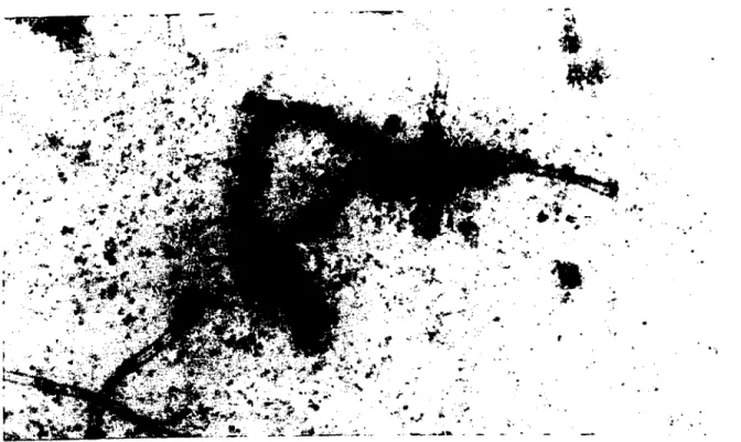 Şekil 8. Tip 3 XY kromozomu.PTA.x 13500. Figure 8. Type 3 XY chromosome. PT A.x 13500.