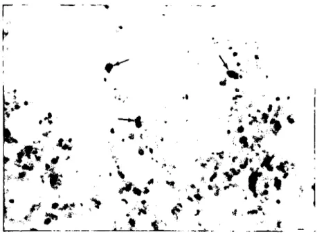 Şekil 4. Akciger'dc bronşiyol'ün çevresinde mast hücreleri (oklar). Tolııidin bluc. x 165