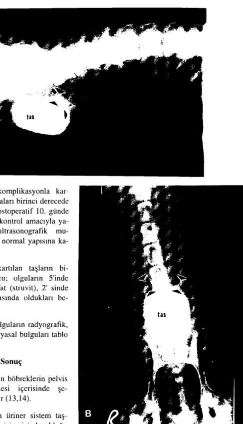 Figure 2. The laterolateral (A) and ventrodorsal (B) ra- ra-diographic appearances of cas e number 3
