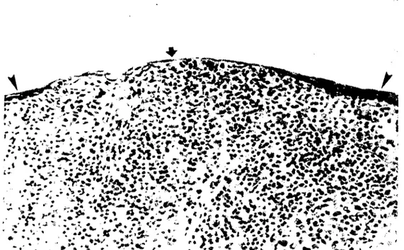 Figure i. Lymphoid (a) and nonlymphoid (b) arca of conjıınctiva. arrow : Iymphoid epitheliıım
