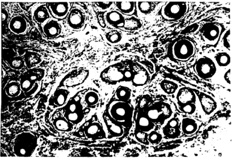 figure ı .The appearanee of dermis in German Blackhead skin (Sumıner). i : sweal glands