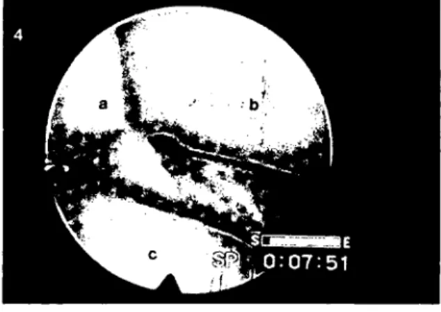 Figure 4. a- os carpi ulnare , h- os carpi intermedium, e- os carpale quartum