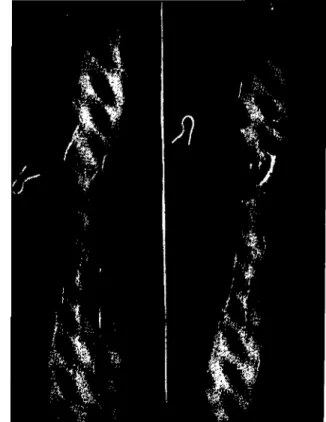Şekil 3. Sag dıstal tibia bölgesının radiografık görıimiımı. Figurc 3. Radiographical appearence of right