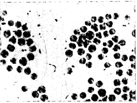 Şekil 2. Perifer kan frotisİnde Theileria spp (Gİemsa x 1000) Figure 2. Theileria sp. in the blood smear ( Giemsa x 1000)