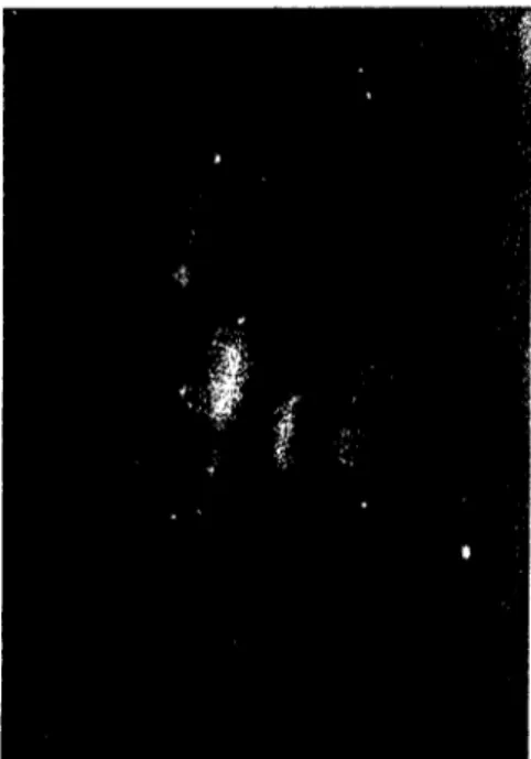 Figure i .Large clump of fluorescing nasal epithelial eells X ı 60