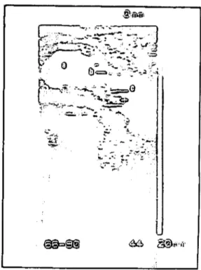 Şekil 3. 41-50 gün grubunda saptanan ultrasonografik bulgular Figure 3. Ultrasonographic findings determined in Group 4 i-50