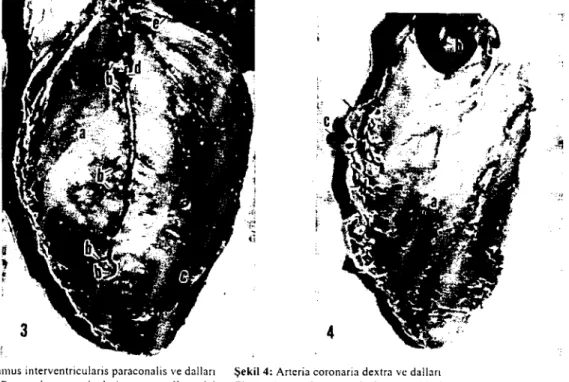 Şekil 3: Ramus interventricuiarjs paraconalis ve dalları Figure 3: Ramus inlerventricularis paraconalis and iıs