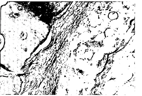 Figure 5. L . ayıng graft lo ıhe . .