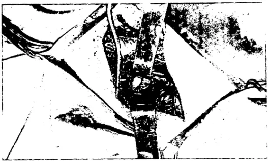 Figure 2. The apperance of the joint surface at the shoulder joint arthrotomy operation.