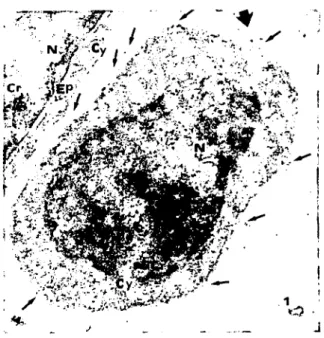 Figure I: A large irregular shapcd single HPL+ cortical thymocyte (thick arrow) and a part of thymic epithelial cell (Ep)
