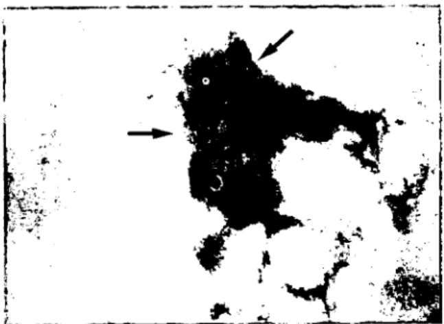 Figure 2. BRV partides detected in fecal specimens by EM (Magnification x 300.000).
