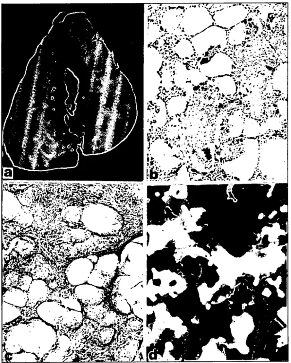 Figure ı a. Gross appearance of fat necrosis in cross-section of the colon that had been in fixative solution for several days