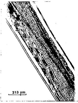 Şekil ı. Habronema muscae'da uzun, kassal ovejektör (O) (Long, muscular ovejector (O) in H