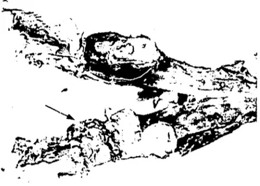 Şekil ı. Köpekte sağ mandibulada tümöral kitlenin (Fibrosarkom) görünümü (ok). Figure i