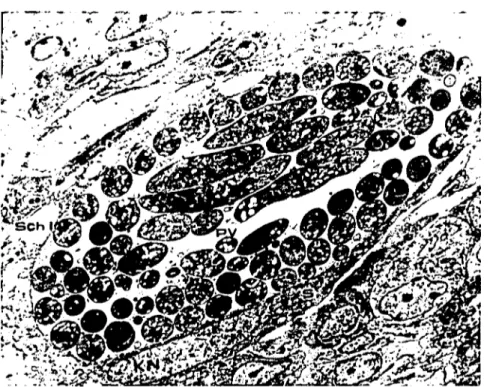 Şekil 3: Barsak propria mukozasında bağ dokusu hücresine benzeyen hücrelcrde II. generasyon merozoitleri içcrcn Şizont