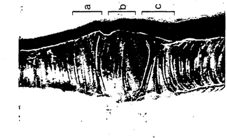 Şekil 12. Denizli horozunda syrinx: Sağ lateral'den görünüş. (Right lateral view of syrinx of the Denizli cock)