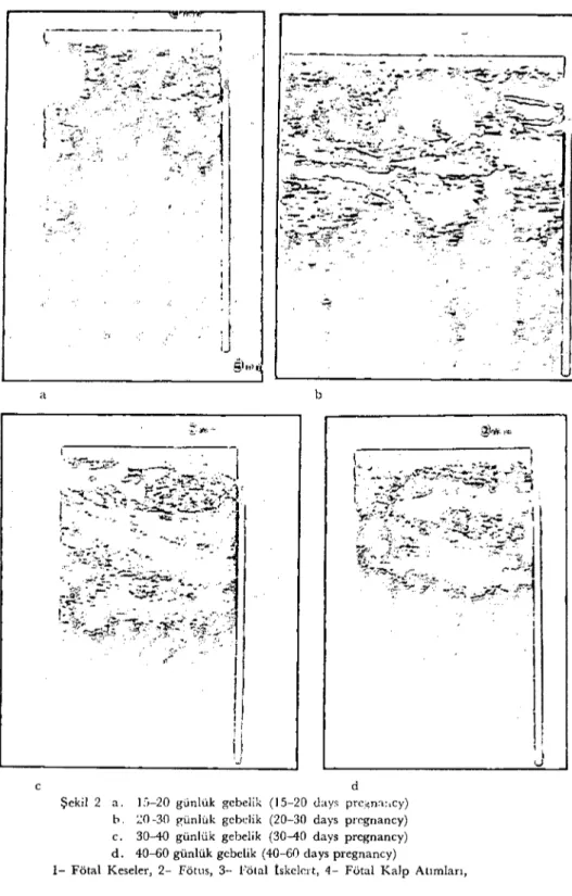 Şekil 2 a. 1:;-20 günlük gebelik (15-20 days prc~n,,:,cy) h. ::0.30 günlük gebdik (20-30 days pl'cgnancy) c