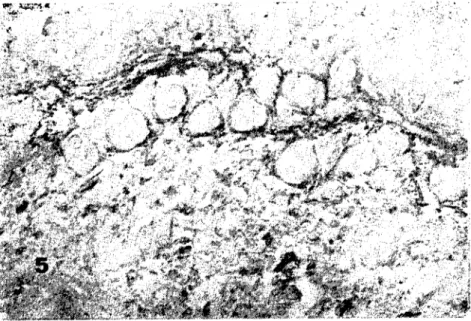 Şekil 4. Sırt bölgesinde derinin retiküler katmanı. Fibrosit ve fibroblast'ların çekirdekleri görülmekte