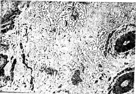 Şekil 6. Bacak bölgesinde derinin stratum papiııare katmanı. H.-E.) x 120.