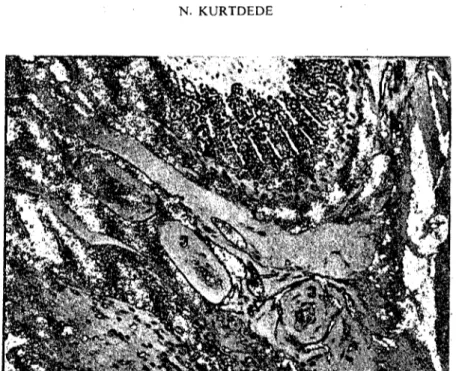 Şekil 9. IS günlük tavukta Herbst korpuskülleri. a) Tüy foIlikülü, b) Tüy kaslarına ve Herbst korpusküllerine gelen bir sinir teli demeıi, e: Herbst korpuskülü