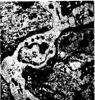 Şekil 7. G aylık ıanıkta epiderınisde keratinmitler arasınd:ı bir Langerhans hüercsi, ç) Çekirdek, oklar: Sitoplazmik uzantılar