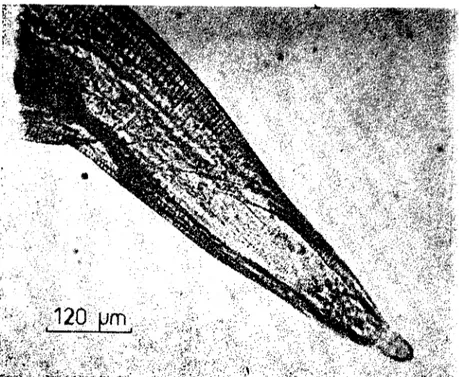 Şekil 2. Dcntos(omella translucida dişi arka nihayeti. (Postcrior cnd of fcmale D. transIucida).