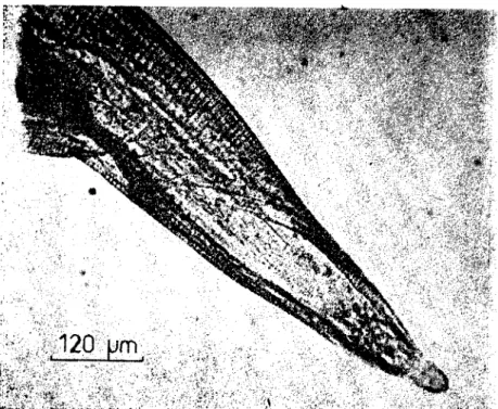 Şekil 2. Dcntos(omella translucida dişi arka nihayeti. (Postcrior cnd of fcmale D. transIucida).