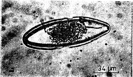 Şekil 3. Dentostomella tr;ınslııcida yumıırtası. (The egg of D. transIııcida)