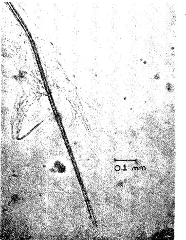 Şekil i. Nematodirus sp., erkek, arka uç. Fig'..lre i. Nematodirus sp., malc, cnd of the postcrior.