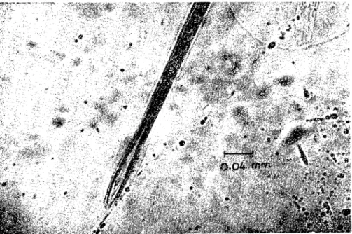 Şekil 2. Nematodirus sp., spikü)üm ucu. Figure 2. Kematodirus sp., end of the ispiculum.