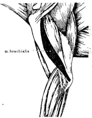 Figure 5. Lateral transposition of brachial ınuscle insertion to thc olecranol processuns.