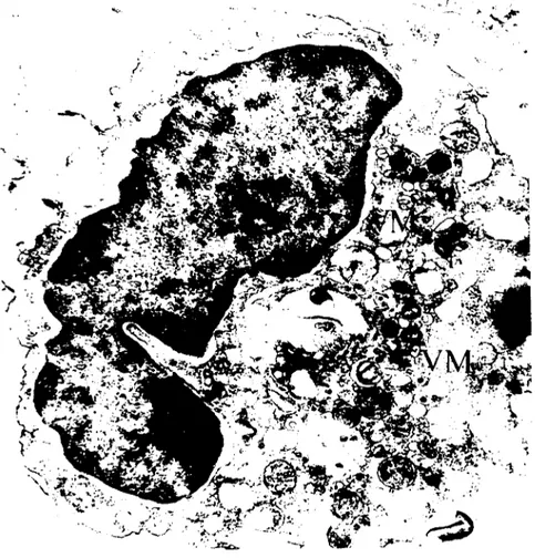 Şekil 13. Bir monosine viral morfogenczis bölgeleri (VM) x 17,630 Viral morphogcnesis foei (VM) in a monoeyle