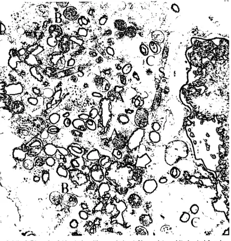 Şekil 16. Rir makrofajda viral replikasyon bölgesi. Yarım daire şeklinde viral formlar (A), yuvarlak