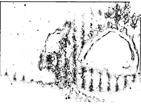 Şekil 4. Heterophyes dispar'ın genila! çekmeni (Geniı al sueker of Heıerophyes dispar)