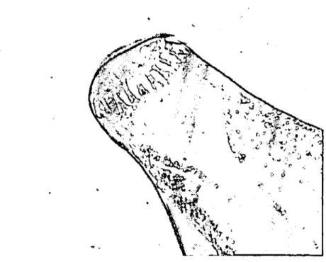 Şekil 5. Phagicola longa'nın ön ucu (anterior end of Phagicola longa)