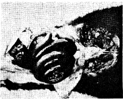 Fig. ı. Yolvulus. Deeply congested loops of the smail intestine Şekil J. Yolvulus. İnce barsak halkalarında şiddetli hiperemi.